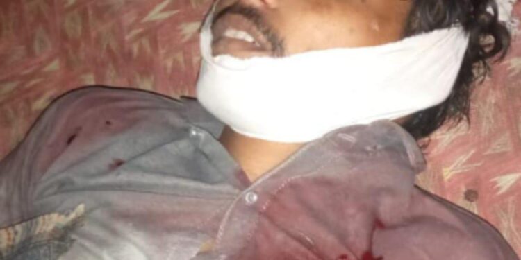 والدکی ڈانٹ ڈپٹ،نوجوان نے خود کو فائر مار کرزندگی کا خاتمہ کرلیا